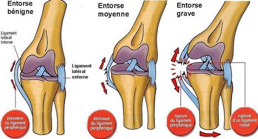 Entorse pour Gautier Larsonneur